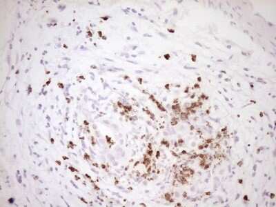 Immunohistochemistry: TFPI Antibody (OTI5H5) [NBP2-46098]