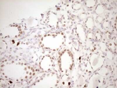 Immunohistochemistry: TFPI Antibody (OTI5H5) - Azide and BSA Free [NBP2-74493]