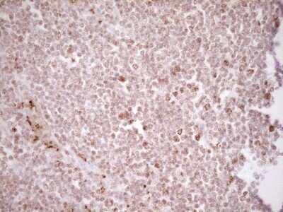 Immunohistochemistry: TFPI Antibody (OTI5H5) - Azide and BSA Free [NBP2-74493]
