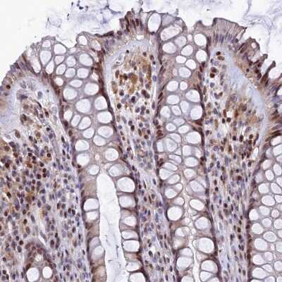 Immunohistochemistry-Paraffin: TGDS Antibody [NBP1-87063]
