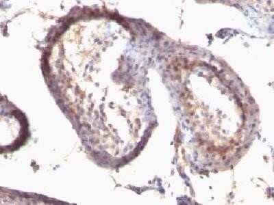 Immunohistochemistry-Paraffin: TGF-alpha Antibody (SPM542) - Azide and BSA Free [NBP2-34418]