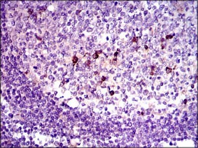 Immunohistochemistry-Paraffin: LAP (TGF-beta 1) Antibody (7F6) - BSA Free [NBP2-22114]