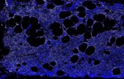 Imaging Mass Cytometry: TGF-beta 1 Antibody [NBP1-80289]