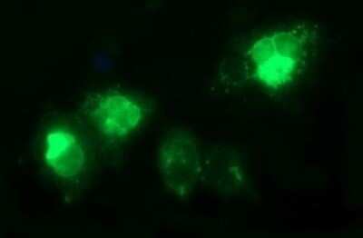 Immunocytochemistry/ Immunofluorescence: TGF-beta 1 Antibody (OTI1E12) - Azide and BSA Free [NBP2-74495]