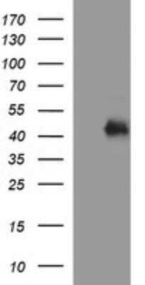 Western Blot: TGF-beta 1 Antibody (OTI1E12)Azide and BSA Free [NBP2-74495]