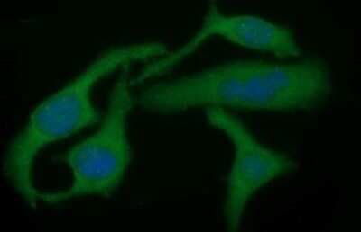 Immunofluorescence: TGF-beta 1 Antibody (OTI1E12) [NBP2-46108]