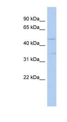 Western Blot: TGF-beta 3 Antibody [NBP1-58287]