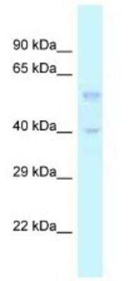 Western Blot: TGF-beta 3 Antibody [NBP1-82416]