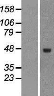 Western Blot: TGF-beta 3 Overexpression Lysate [NBP2-10880]