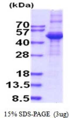 SDS-PAGE: Recombinant Human TGF-beta 3 His Protein [NBP2-52029]