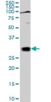 Western Blot: TGF beta induced factor 2 Antibody (5B11) [H00060436-M02]