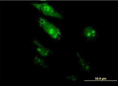 Immunocytochemistry/ Immunofluorescence: TGF beta induced factor 2 Antibody (6A8) [H00060436-M06]