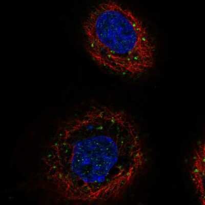 Immunocytochemistry/ Immunofluorescence: TGFBRAP1 Antibody [NBP2-58528]
