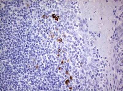 Immunohistochemistry: TGIF1 Antibody (OTI1B12) [NBP2-46109]