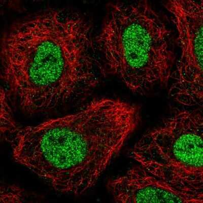 Immunocytochemistry/ Immunofluorescence: TGIF1 Antibody [NBP2-55829]