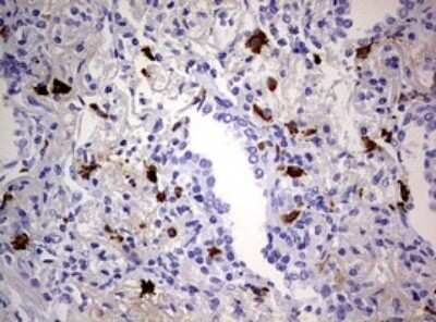 Immunohistochemistry: TGIF1 Antibody (OTI1B12) - Azide and BSA Free [NBP2-74496]