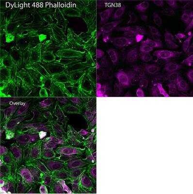 Immunocytochemistry/ Immunofluorescence: TGN38 Antibody (2F7.1) [NB300-575]
