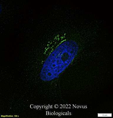 Immunocytochemistry/ Immunofluorescence: TGN46 Antibody - BSA Free [NBP1-49643]