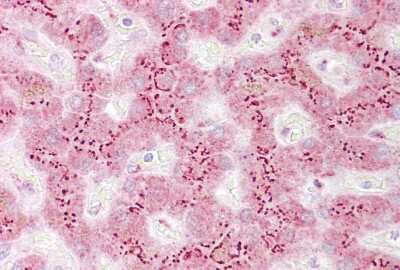Immunohistochemistry-Paraffin: TGN46 Antibody [NBP1-62556]