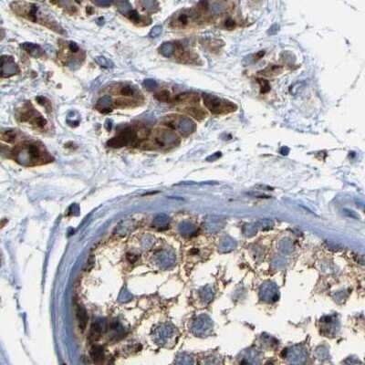 Immunohistochemistry-Paraffin: TGN46 Antibody [NBP1-86948]