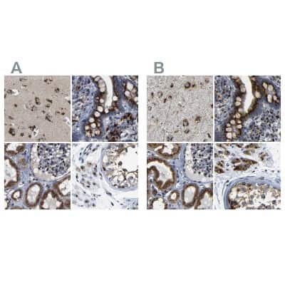 Immunohistochemistry-Paraffin: TGN46 Antibody [NBP1-86949]