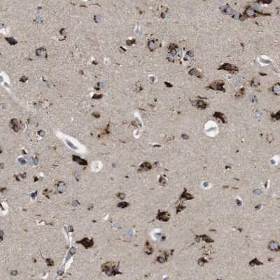 Immunohistochemistry-Paraffin: TGN46 Antibody [NBP1-86949]