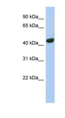 Western Blot: TGN46 Antibody [NBP1-62556]