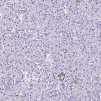 Immunohistochemistry-Paraffin: TGR5/GPBAR1 Antibody [NBP2-49376]