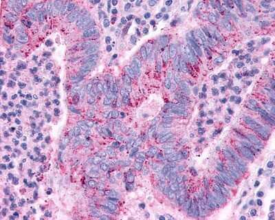 Immunohistochemistry-Paraffin: TGR5/GPBAR1 Antibody - BSA Free [NLS1937]