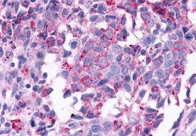 Immunohistochemistry-Paraffin: TGR5/GPBAR1 Antibody - BSA Free [NLS1937]