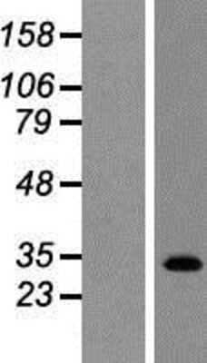 Western Blot: TGR5/GPBAR1 Overexpression Lysate [NBP2-05211]