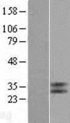 Western Blot: TGR5/GPBAR1 Overexpression Lysate [NBP2-11455]