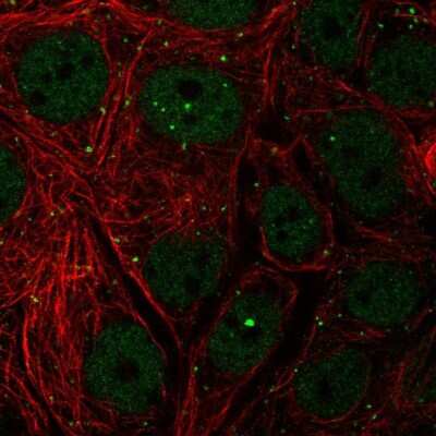Immunocytochemistry/ Immunofluorescence: TH1L Antibody [NBP2-55400]