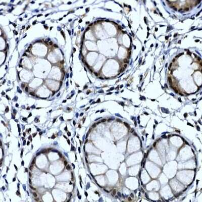 Immunohistochemistry-Paraffin: TH1L Antibody - Azide and BSA Free [NBP3-16475]