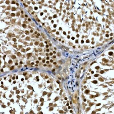Immunohistochemistry-Paraffin: TH1L Antibody - Azide and BSA Free [NBP3-16475]