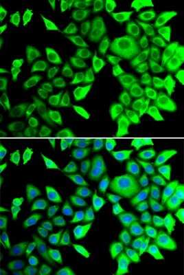 Immunocytochemistry/ Immunofluorescence: THADA Antibody - BSA Free [NBP2-93002]