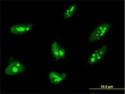 Immunocytochemistry/ Immunofluorescence: THAP1 Antibody (2C1-2F2) [H00055145-M01]