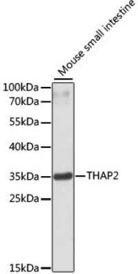Western Blot: THAP2 AntibodyAzide and BSA Free [NBP2-94861]