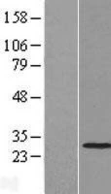Western Blot: THAP2 Overexpression Lysate [NBL1-16873]