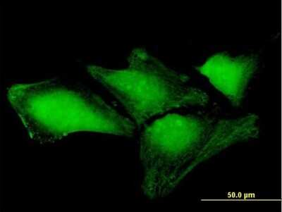 Immunocytochemistry/ Immunofluorescence: THAP4 Antibody [H00051078-B01P]