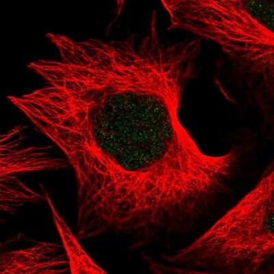 Immunocytochemistry/ Immunofluorescence: THAP5 Antibody [NBP2-55522]