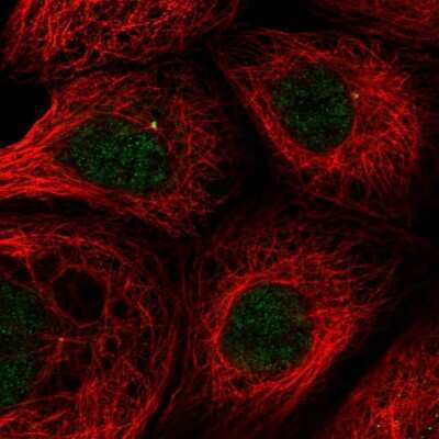 Immunocytochemistry/ Immunofluorescence: THAP6 Antibody [NBP1-81130]