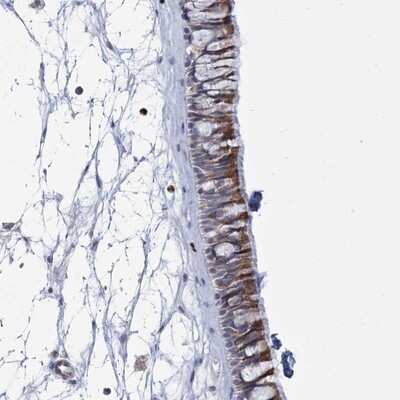 Immunohistochemistry-Paraffin: THAP6 Antibody [NBP1-81130]