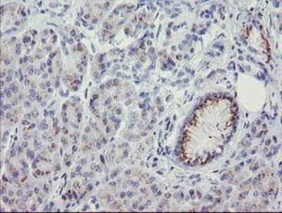 Immunohistochemistry: THAP6 Antibody (OTI1F6) - Azide and BSA Free [NBP2-74497]
