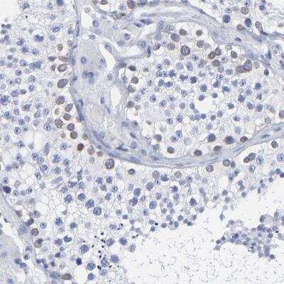 Immunohistochemistry-Paraffin: THAP7 Antibody [NBP1-81232]