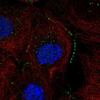 Immunocytochemistry/ Immunofluorescence: THEM2 Antibody [NBP1-92498]
