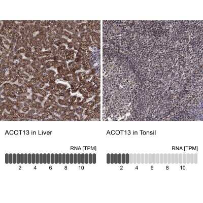 Immunohistochemistry-Paraffin: THEM2 Antibody [NBP3-16979]