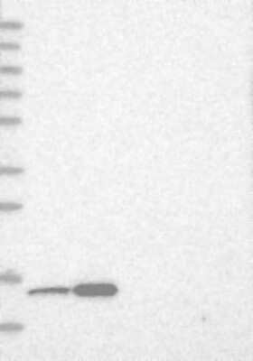 Western Blot: THEM2 Antibody [NBP1-92498]