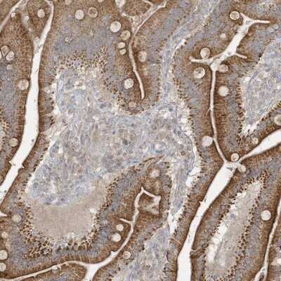 Immunohistochemistry-Paraffin: THG1L Antibody [NBP1-82314]