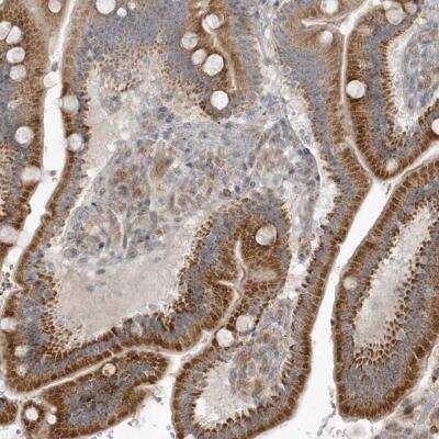 Immunohistochemistry-Paraffin: THG1L Antibody [NBP1-82315]